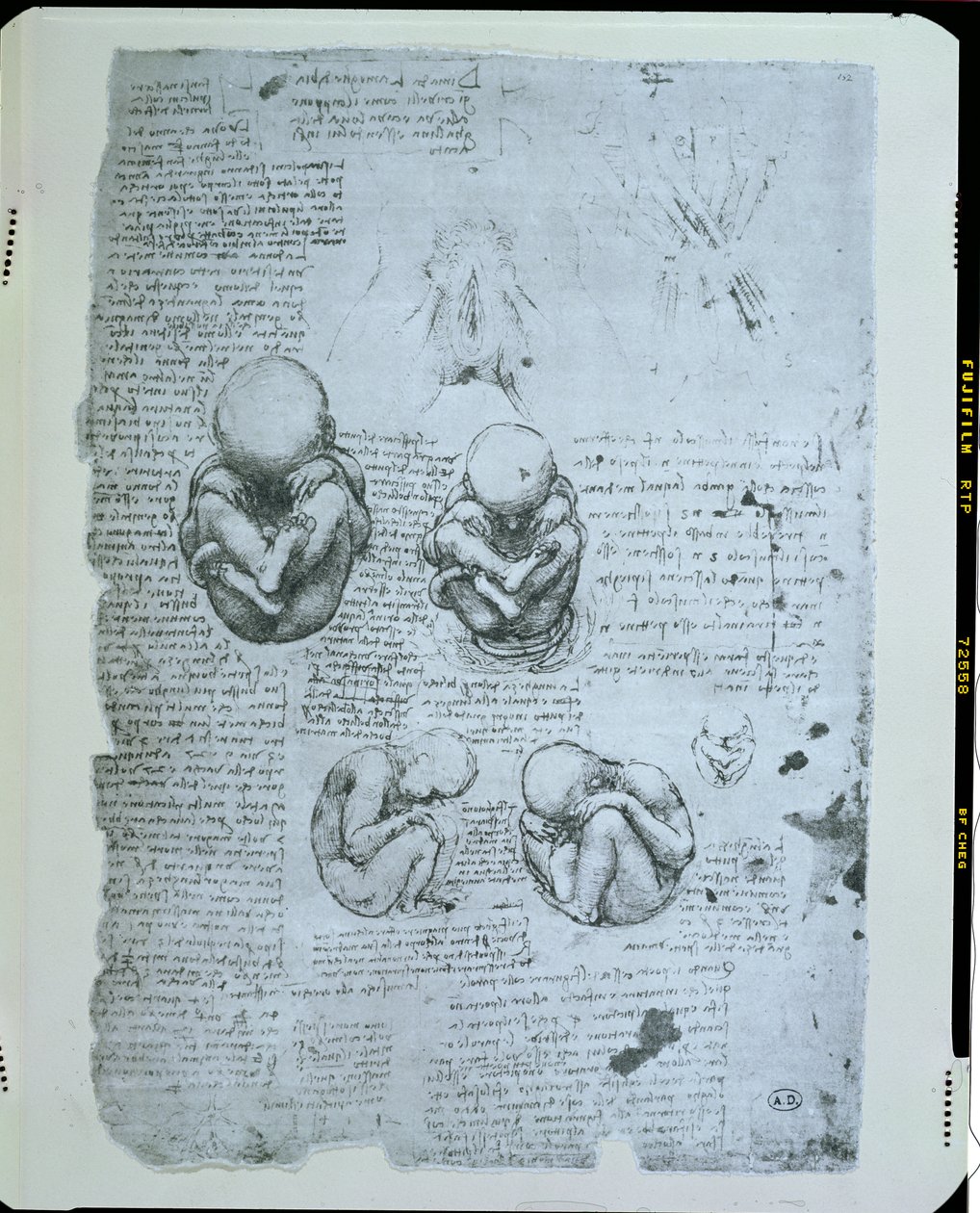 子宫中的五个视图，传真副本 作者 达芬奇（Leonardo da Vinci）