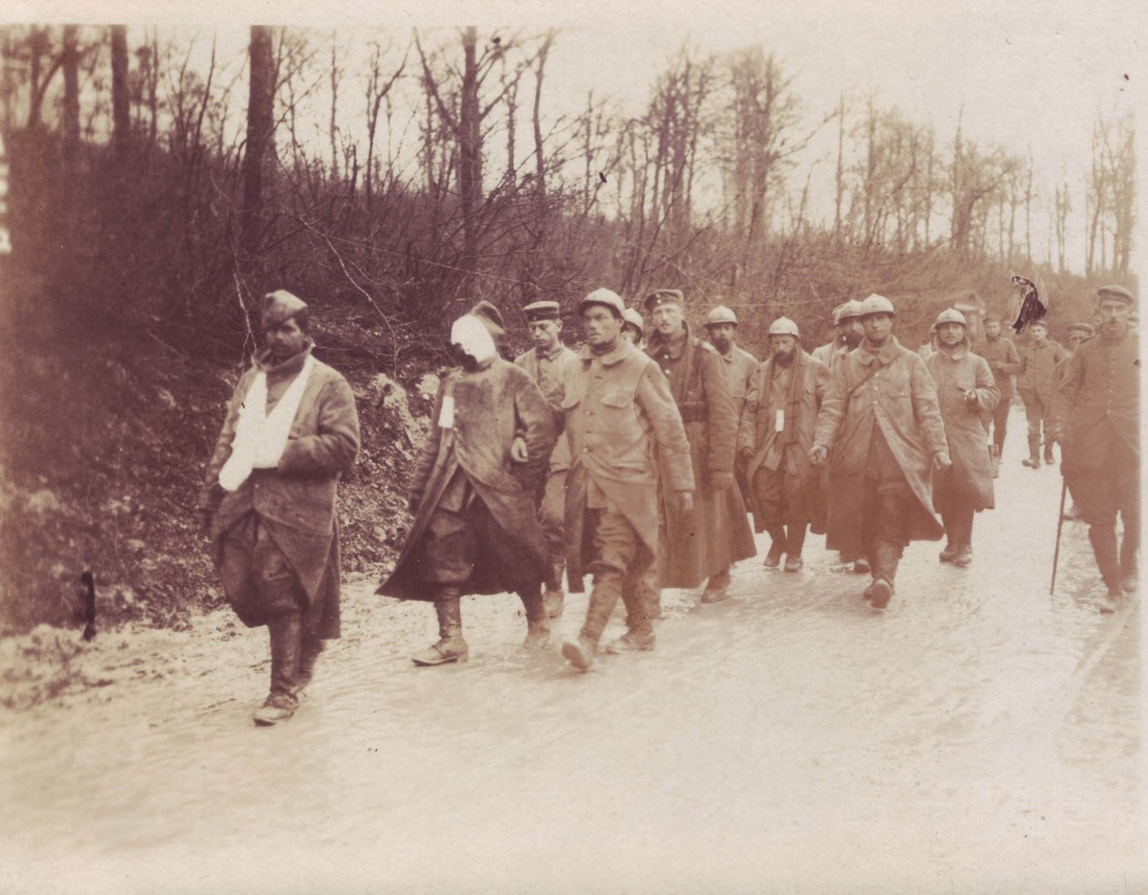 February 1917 - Verdun-Front French prisoners wounded escorted back by German soldiers 作者 未知未知