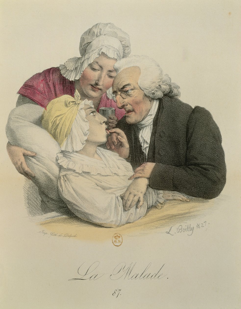患者，由Francois Seraphin Delpech（1778-1825）1827年雕刻 作者 路易斯·利奥波德·博伊