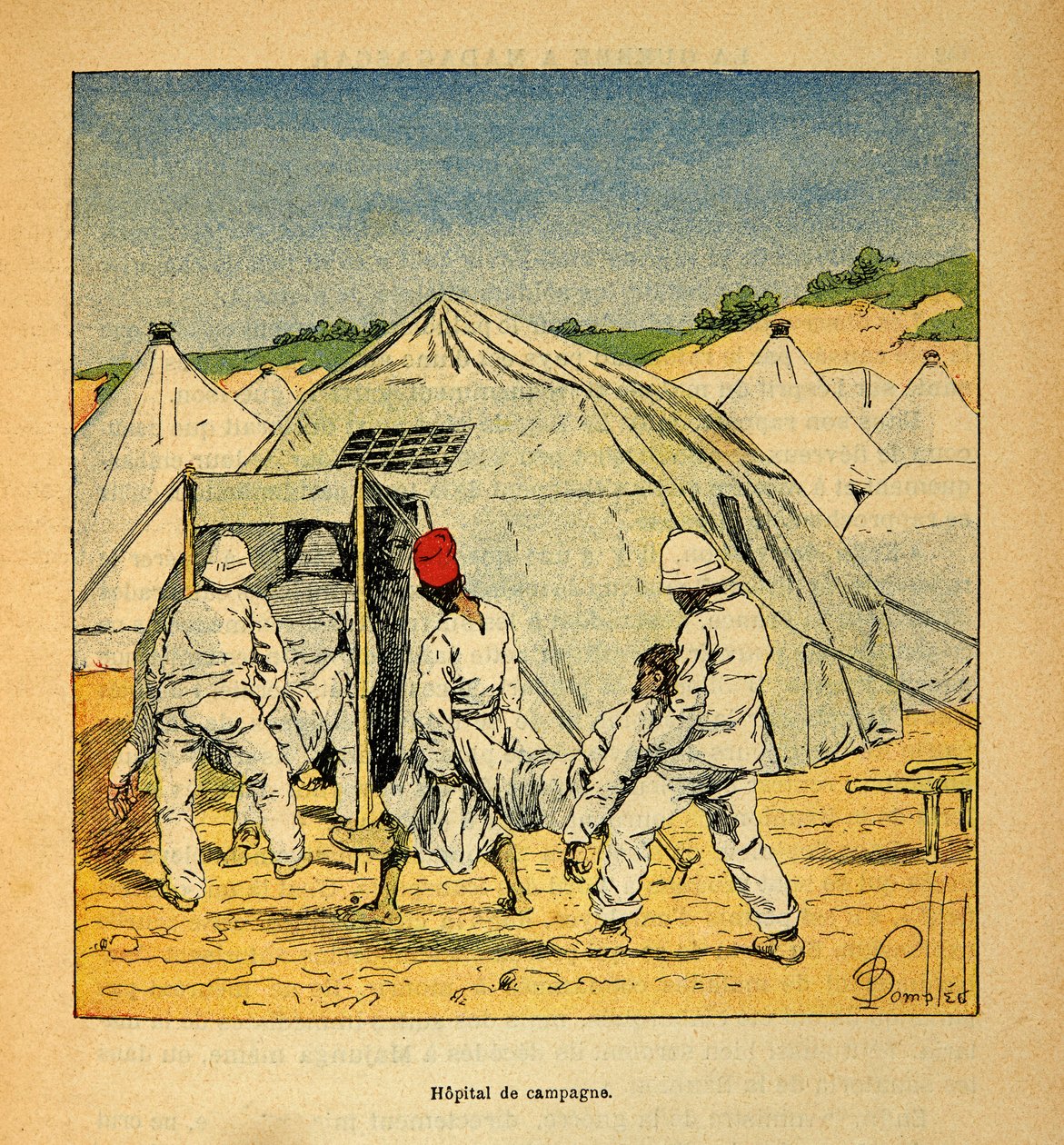 马达加斯加的战争--1885-1895年法国远征的轶事史》，作者亨利-加利（Henri Galli dit Galllichet）（1854-1922），由路易斯-邦布雷（Louis Bombled）（1862-1927）插图。1895年在马达加斯加的军事野战医院，私人收藏 作者 路易斯·查尔斯·邦布尔