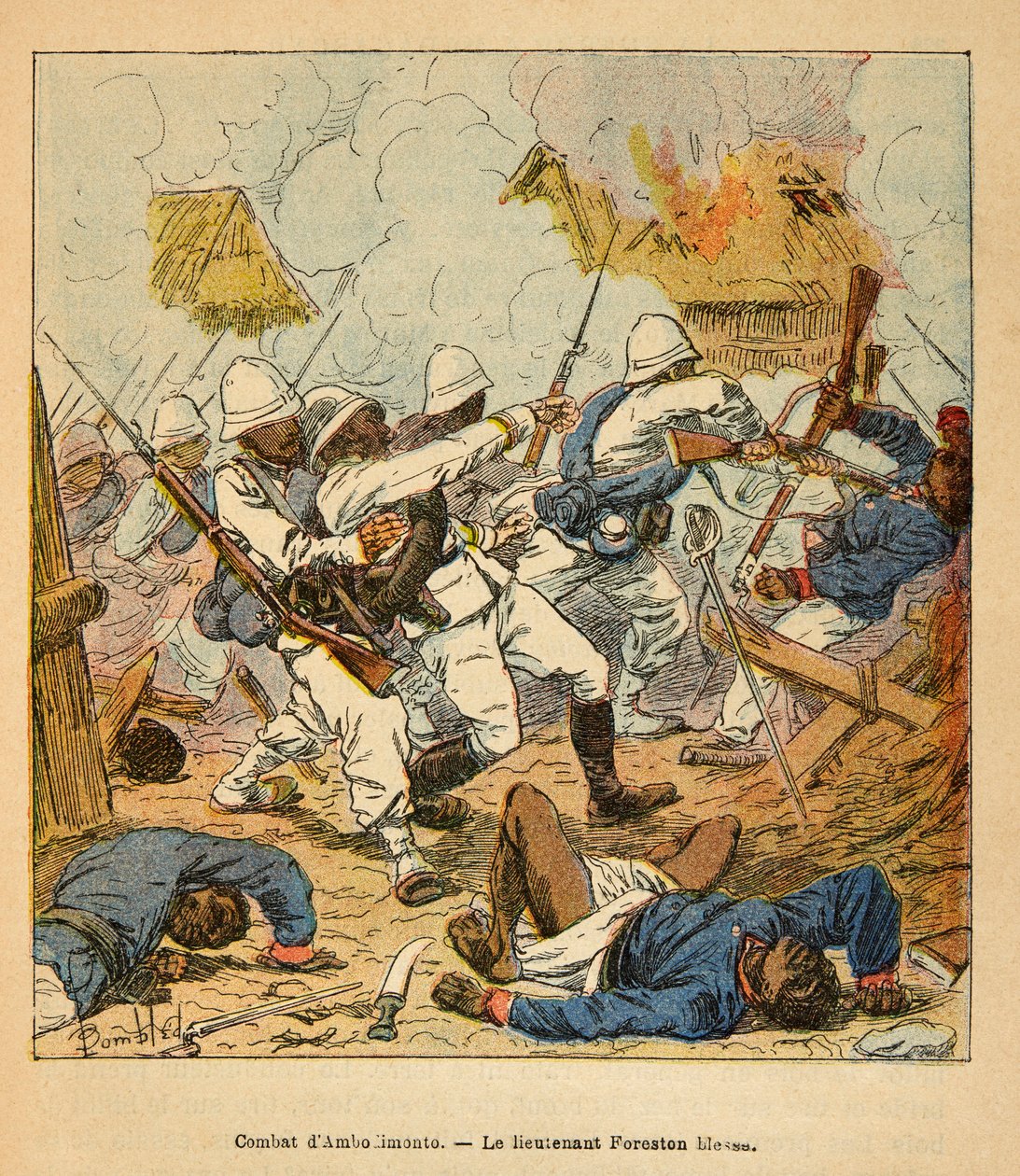 马达加斯加的战争--1885-1895年法国远征的轶事史》，作者是亨利-加利（Henri Galli dit Galllichet）（1854-1922），由路易斯-邦布尔（Louis Bombled）（1862-1927）绘制。福尔斯顿中尉在1895年的阿姆博尔蒙蒂战斗中的伤口，私人收藏 作者 路易斯·查尔斯·邦布尔