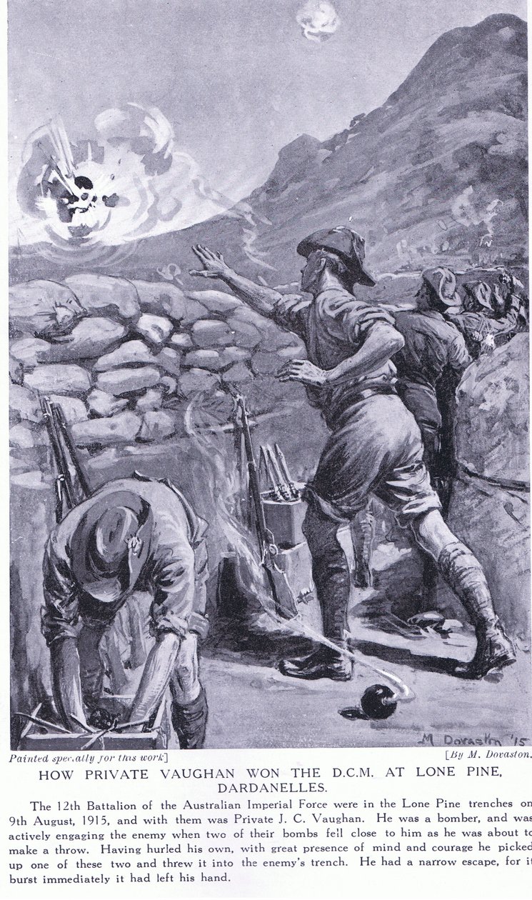 二等兵沃恩如何在 1915 年 8 月孤松达达尼尔海峡赢得 DCM（平版） 作者 玛格丽特·多瓦斯顿