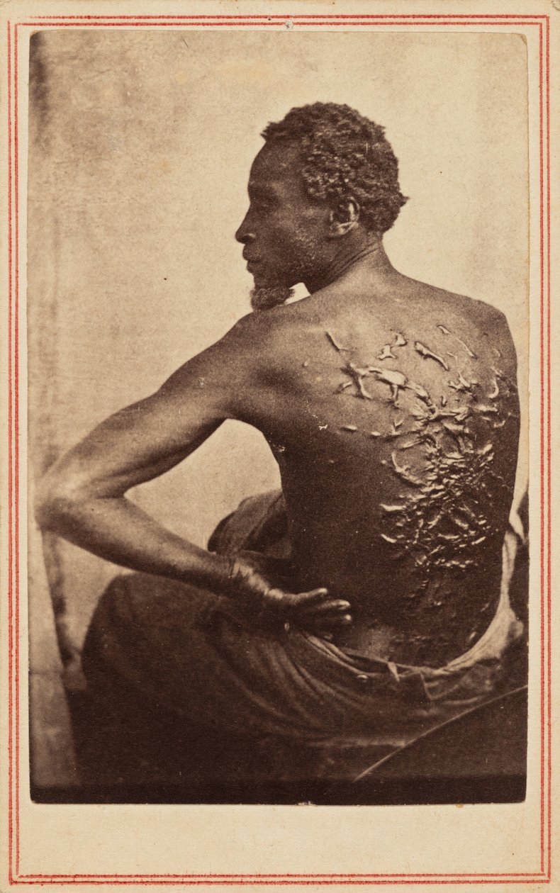 受难的背影，约 1863 年1863 年（照片） 作者 麦克弗森和奥利弗