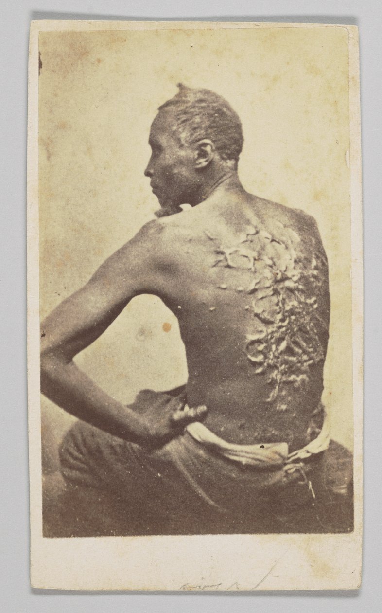 戈登接受医疗检查，1863年。 作者 麦克弗森和奥利弗