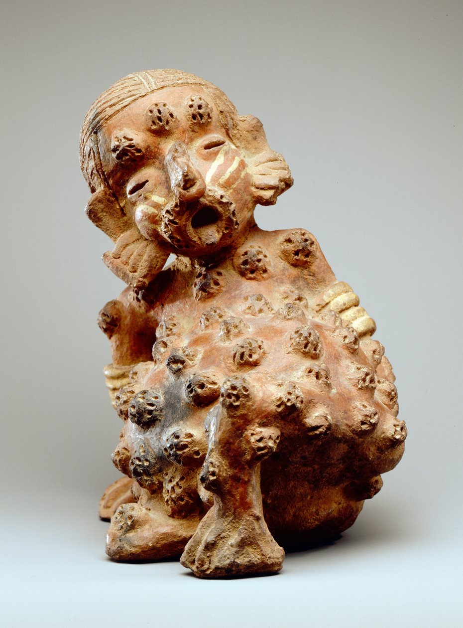 男性人物与疮（陶器） 作者 纳亚里特