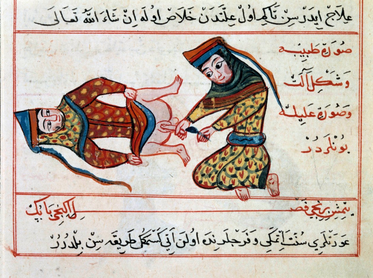 医学：两性炎的手术。 Sharaf al-din 的土耳其医学疗法的缩影 作者 奥斯曼帝国学校