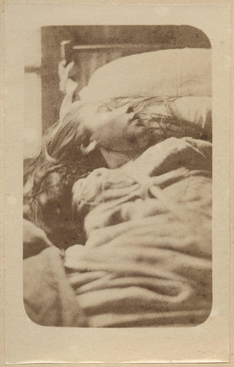 歇斯底里的攻击，第一阶段，来自&39;Iconographie Photographique de La Salpetriere&39;的插图由Bourneville et P. Regnard，第二板，巴黎，1876年（蛋白印刷品） 作者 保罗·雷纳德