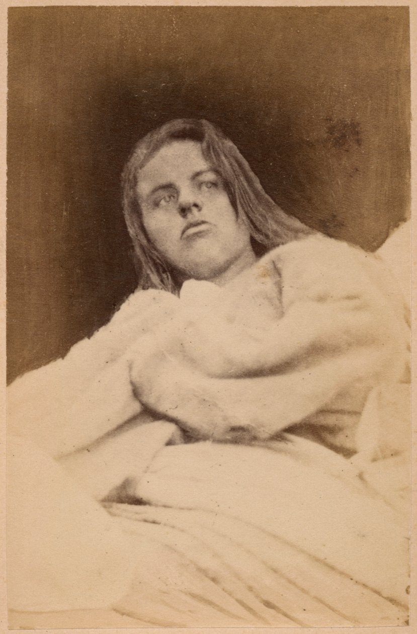 歇斯底里的癫痫，幻觉，蔑视，来自Bourneville和P. Regnard，1876年巴黎的“La Salpetriere的摄影图像”中的XXXI（蛋白印刷品） 作者 保罗·雷纳德