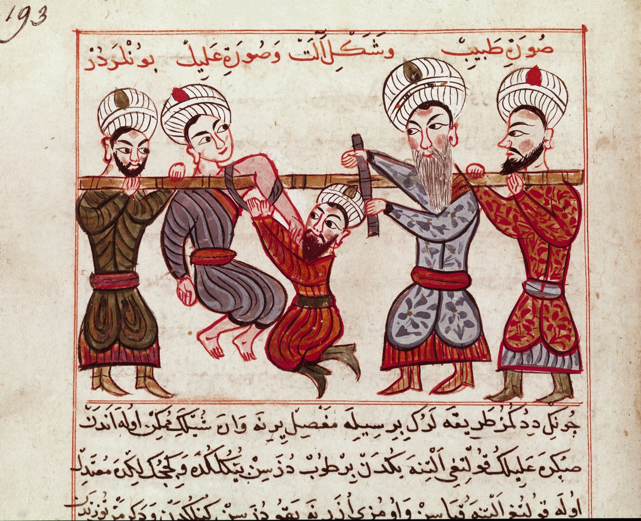 医学：骨科介入。 Charaf-ed-din (Charaf ed Din) (1404-1468) 根据“La Surgery Imperiale”（Sup Turk 女士 693 和 193）1466 巴黎，B.N. 作者 波斯学校