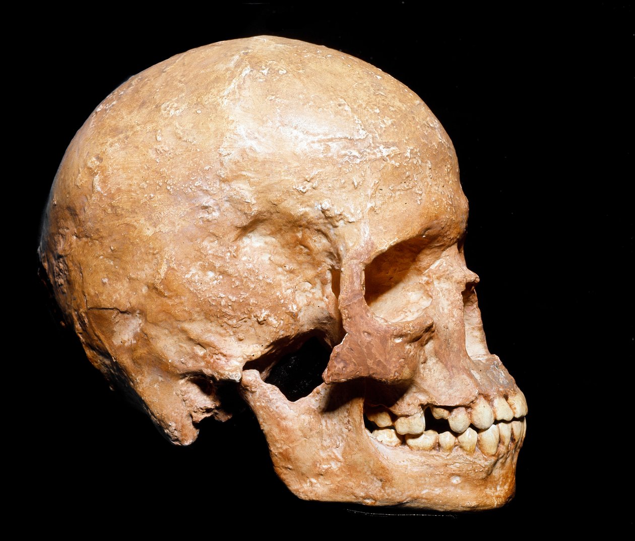史前史：来自格里马尔迪的智人头骨化石。 Aurignacian 文化，旧石器时代晚期。 Museo Civico di Storia Naturale，米兰 - 史前史：来自文蒂米利亚（意大利）格里马尔迪的智人头骨化石。 Aurignacian 文化，旧石器时代晚期 作者 史前史前