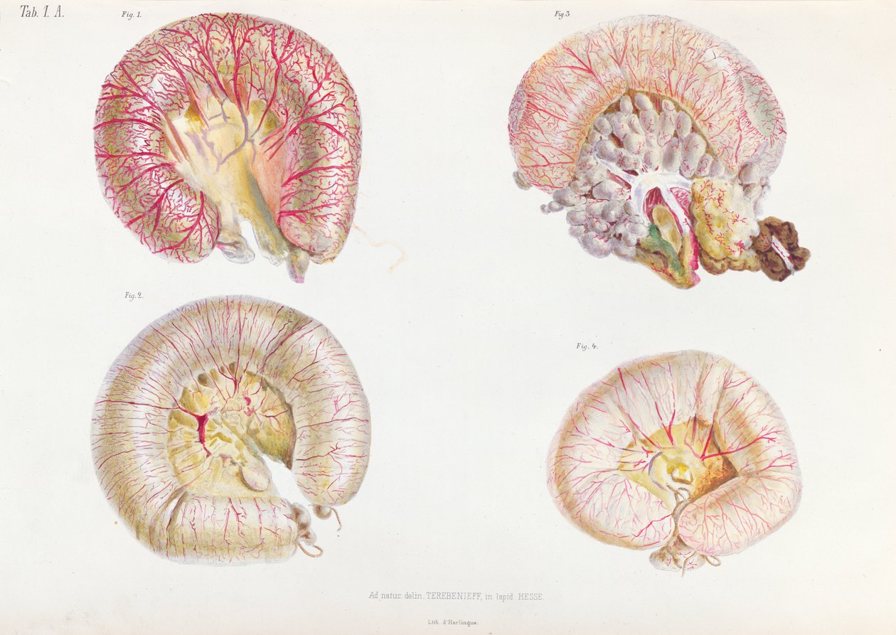 肠道外表面感染霍乱，来自Anoraomie Pathologique du Cholera Morbus，由Nikolai Ivanovich Pirogov（1810-81）于1849年在圣彼得堡出版 作者 俄语学校