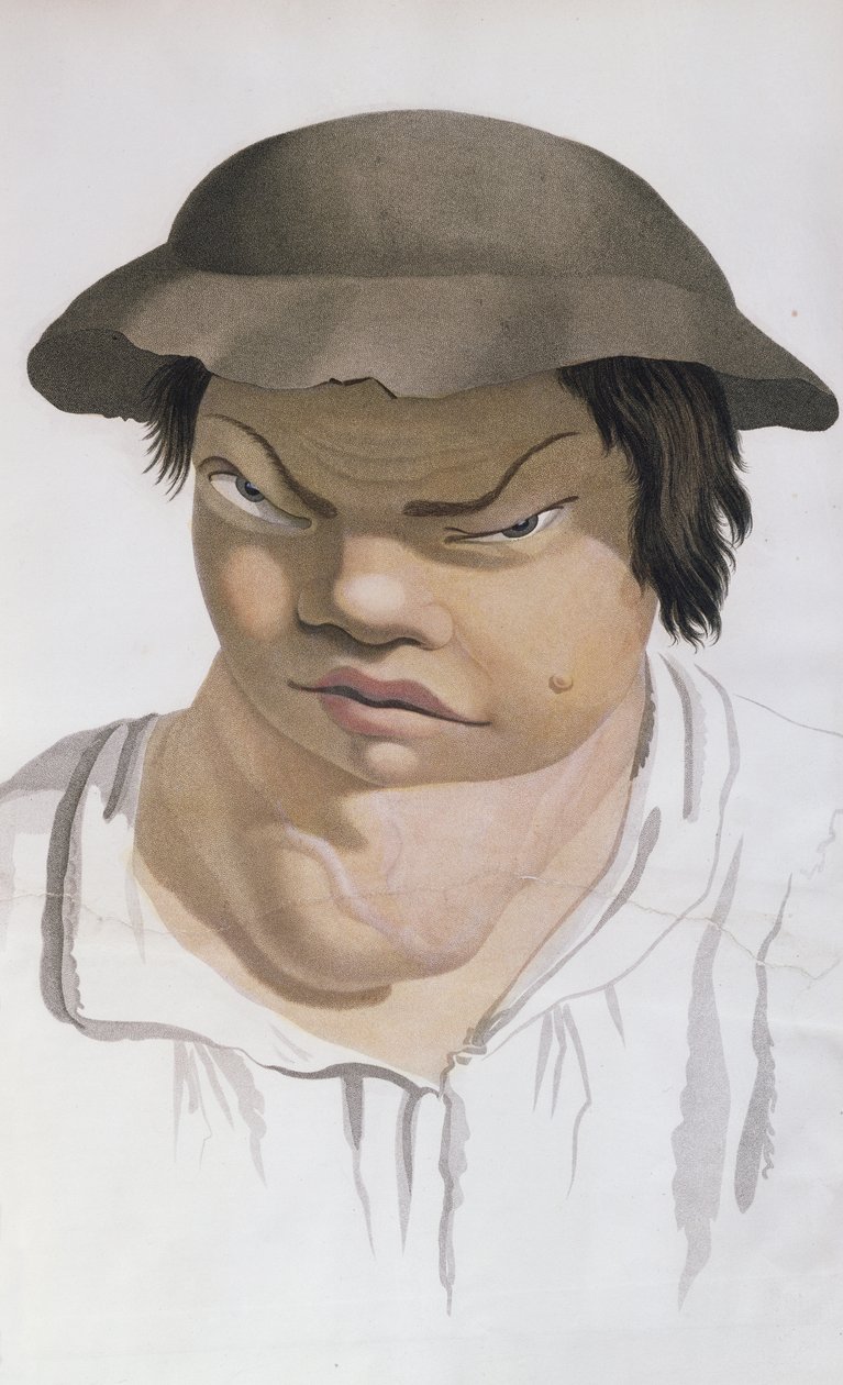 地方性Sc ,,从男爵Jean Louis Alibert（1768-1837）的书中插图 作者 萨尔瓦多·特雷斯卡