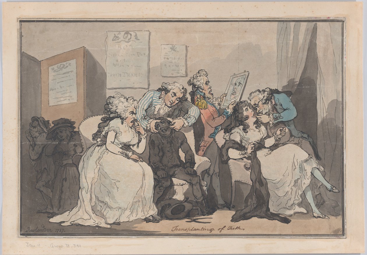 移植牙齿，1787., 1787. 作者 托马斯·罗兰森