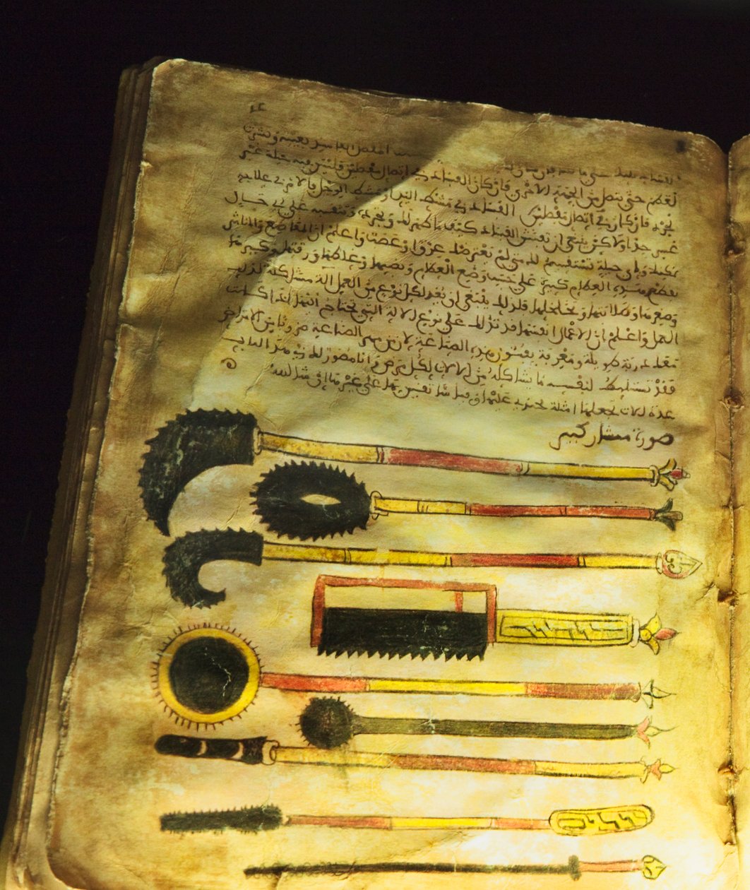 来自&39;On Surgery and Instruments&39;或&39;Al-Zahrawi&39;的插图，作者：Abu al-Qasim al-Zahrawi 作者 未知未知