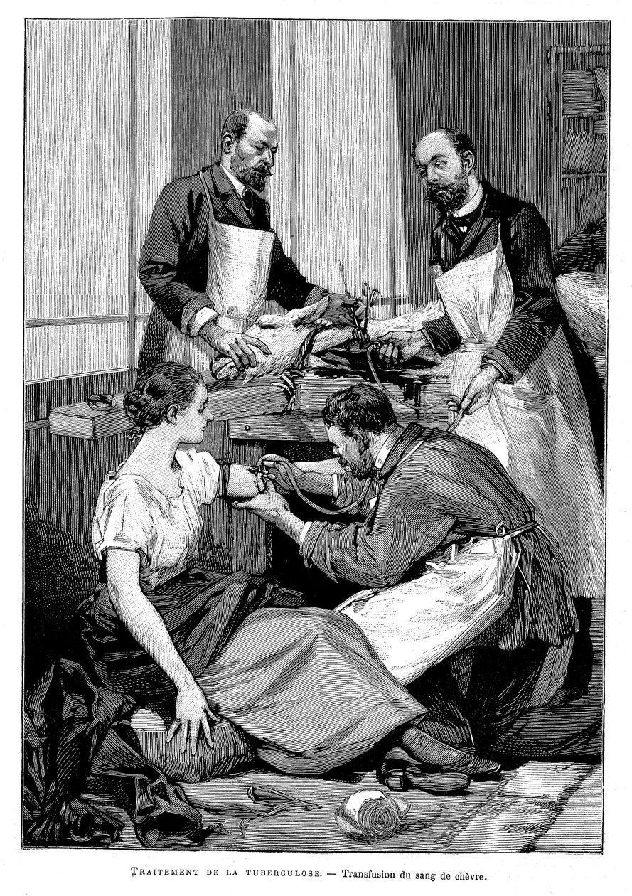1891年，一名结核病患者接受了山羊血液的输血 作者 不明