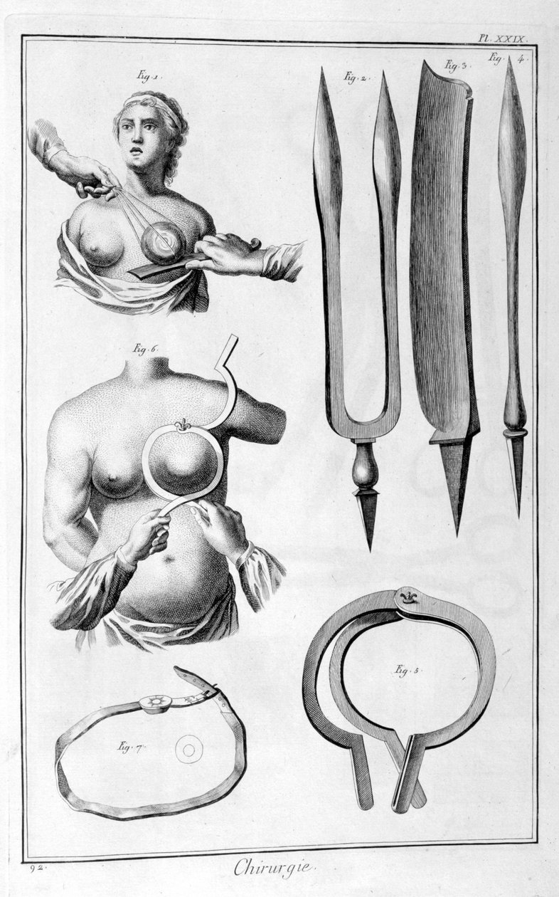 乳房手术，1751-1777年 作者 不明