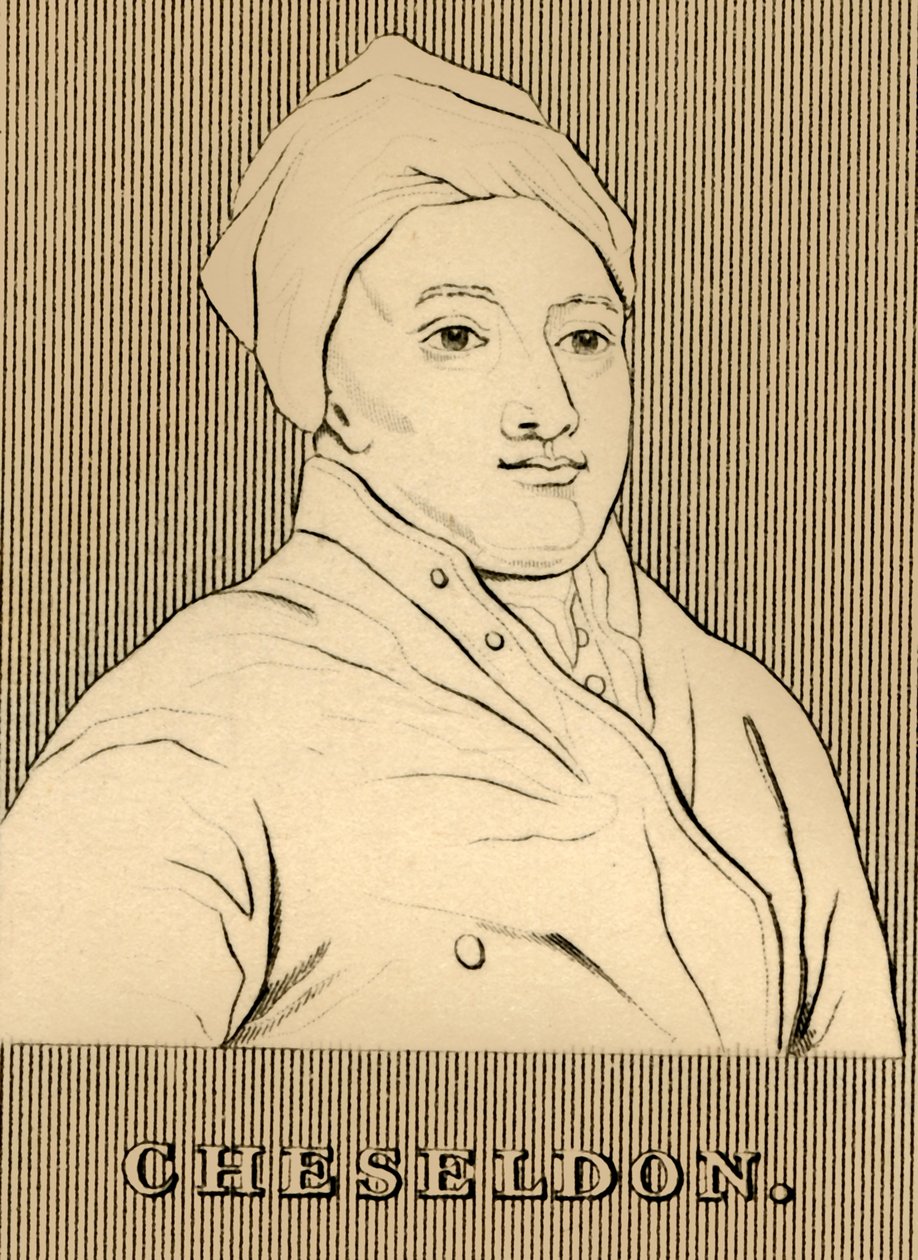 Cheseldon，1688-1752，1830。 作者 不明