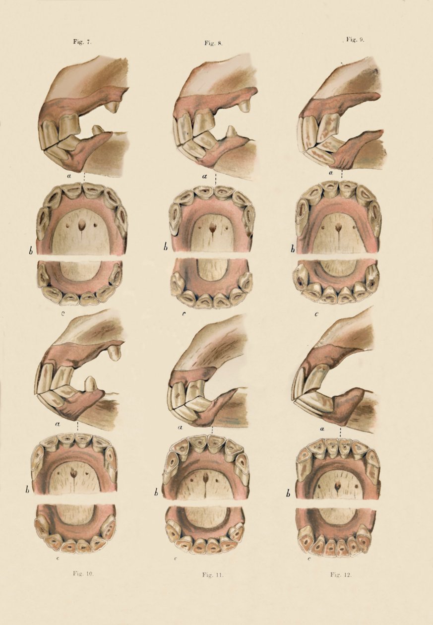 显示牙齿年龄的盘子的描述，如牙齿所示，c1879。 作者 不明