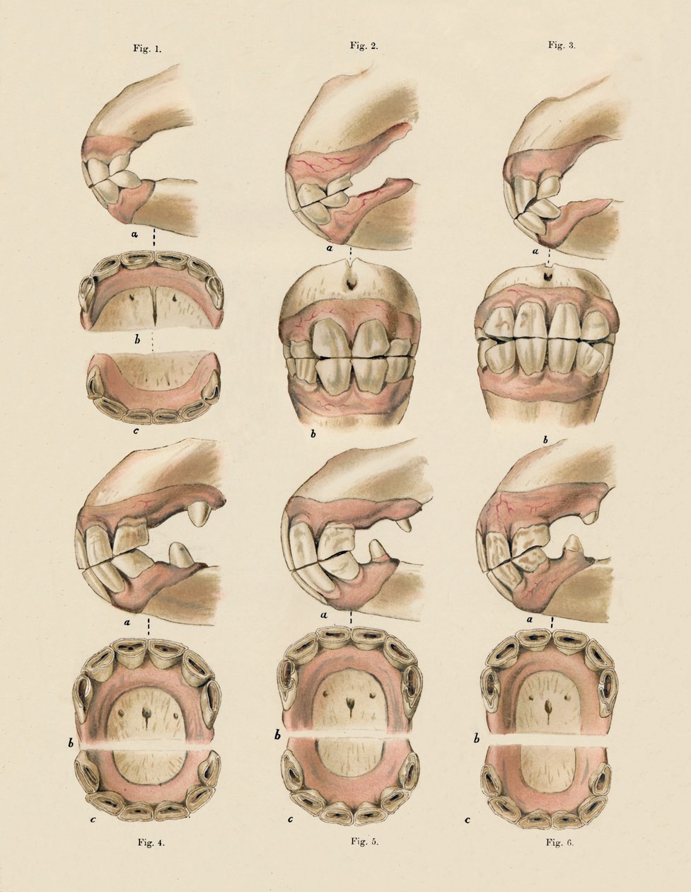 显示牙齿年龄的盘子的描述，如牙齿所示，c1879。 作者 不明