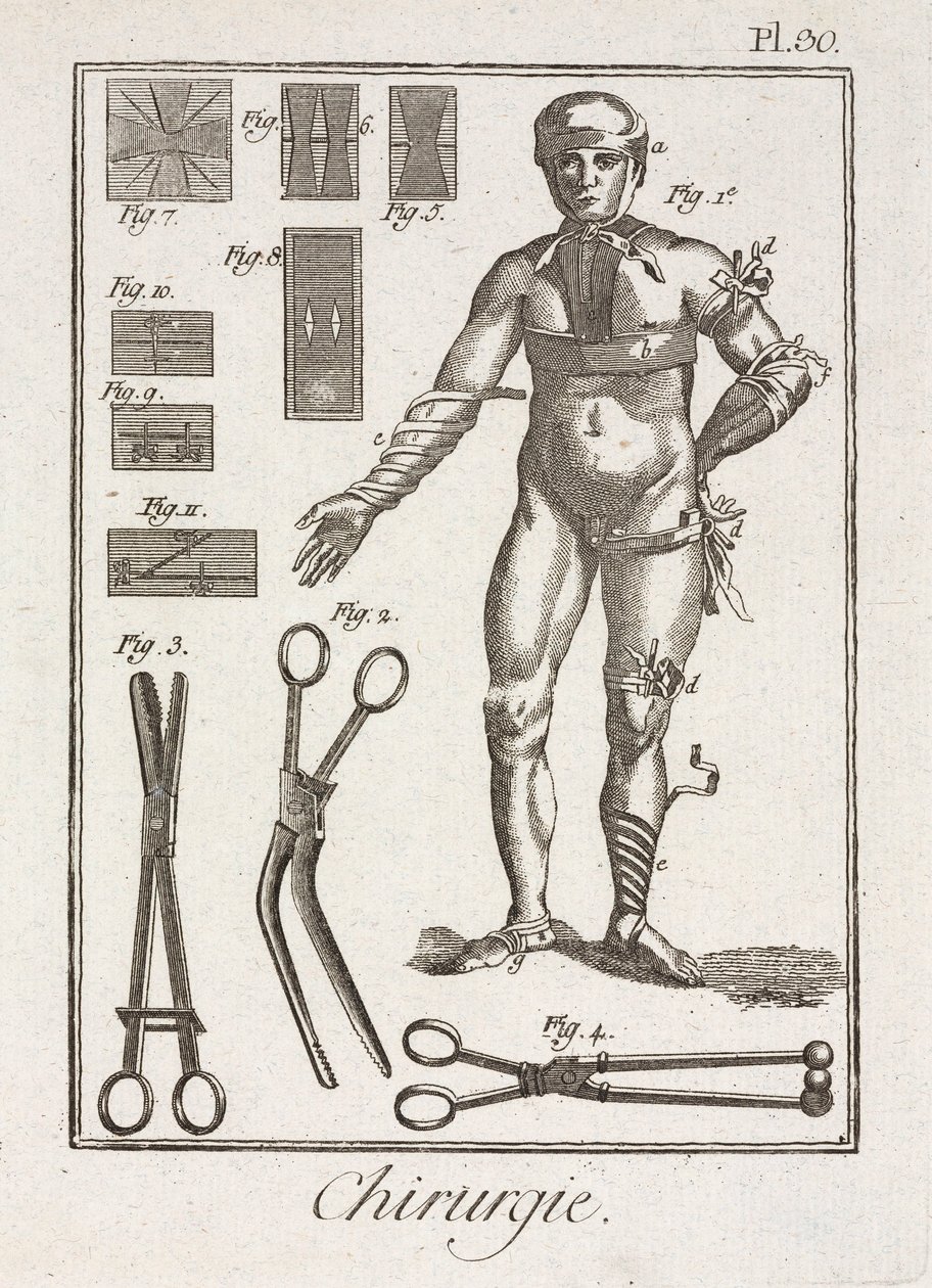 Equipment, Early-Modern Bandaging a human figure 作者 不明