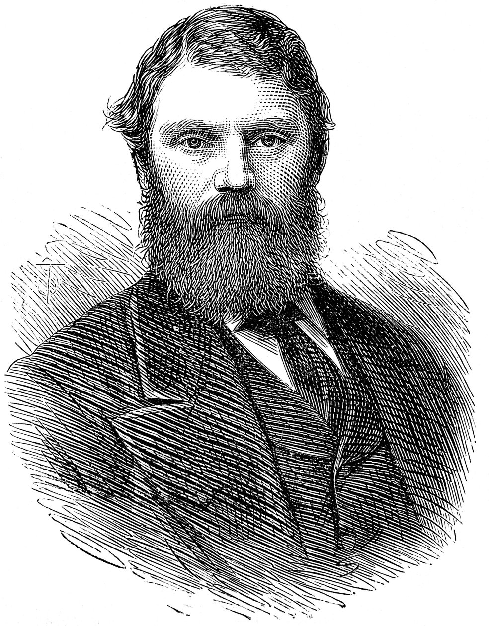 弗朗西斯·埃德蒙·安斯蒂（Francis Edmund Anstie）1833-1874年，英国医师，1874年 作者 不明