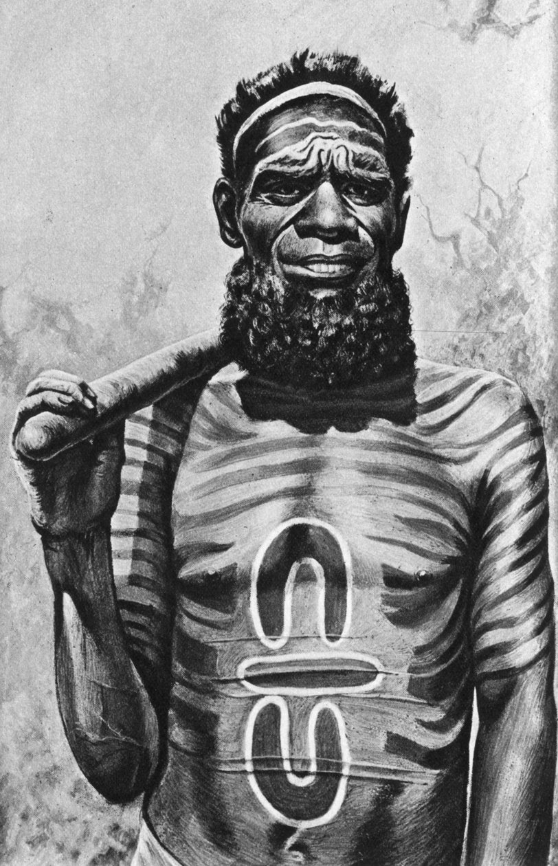 1922年，澳大利亚中部Worgaia的医务人员 作者 不明