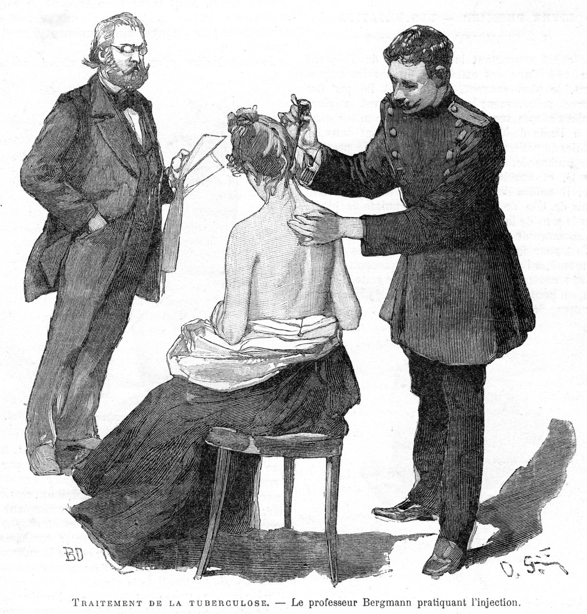 Bergmann教授为一名结核病患者注射，1891年 作者 不明