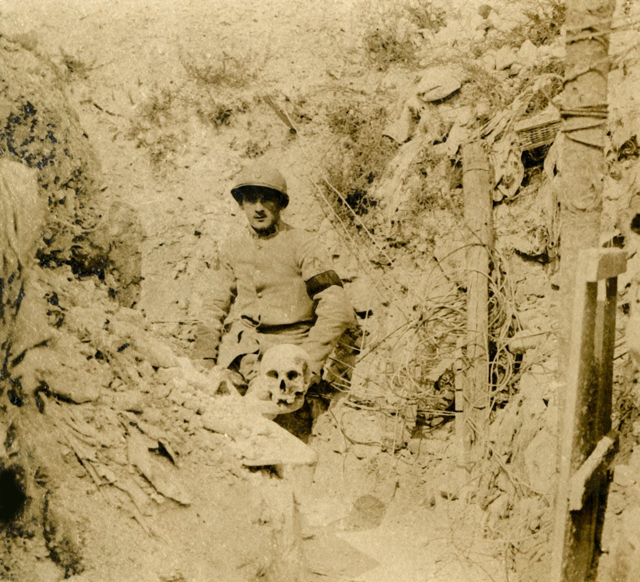 发现头骨埋在战es中，c1914-c1918 作者 不明