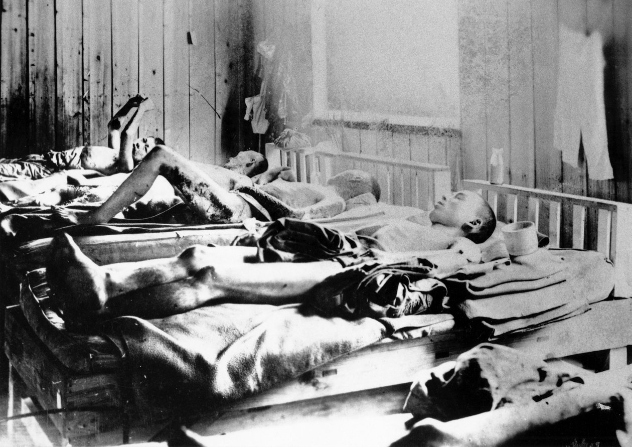 1945年日本广岛原子弹爆炸的幸存者 作者 不明