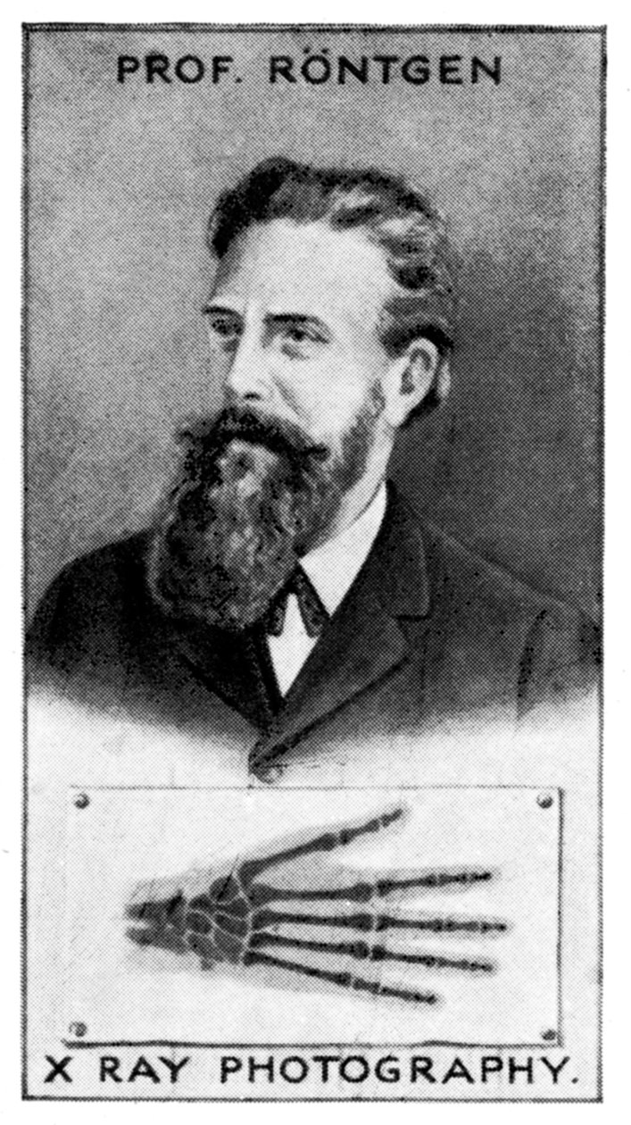 威廉·康拉德·伦琴（Wilhelm Conrad Roentgen），德国物理学家，1924年 作者 不明