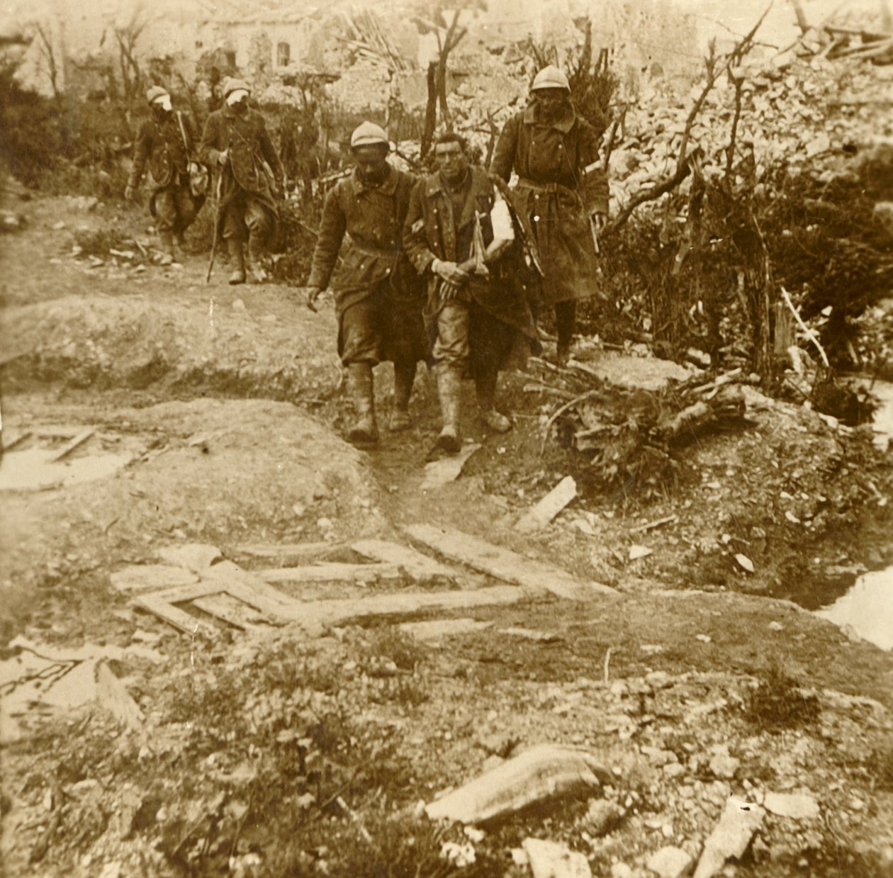 1916年，受伤的法国步兵抵达法国北部凡尔登城堡埃斯纳城堡 作者 不明