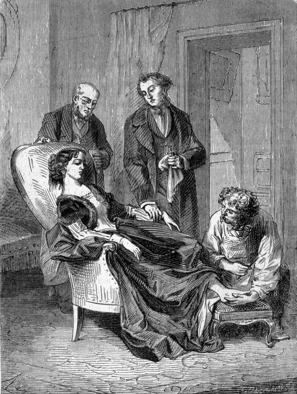 1848 年 1 月 28 日第一次接受氯仿麻醉后，15 岁的女孩汉娜·格林纳 (Hannah Greener) 去世。 1869 年的雕刻。 作者 未知艺术家