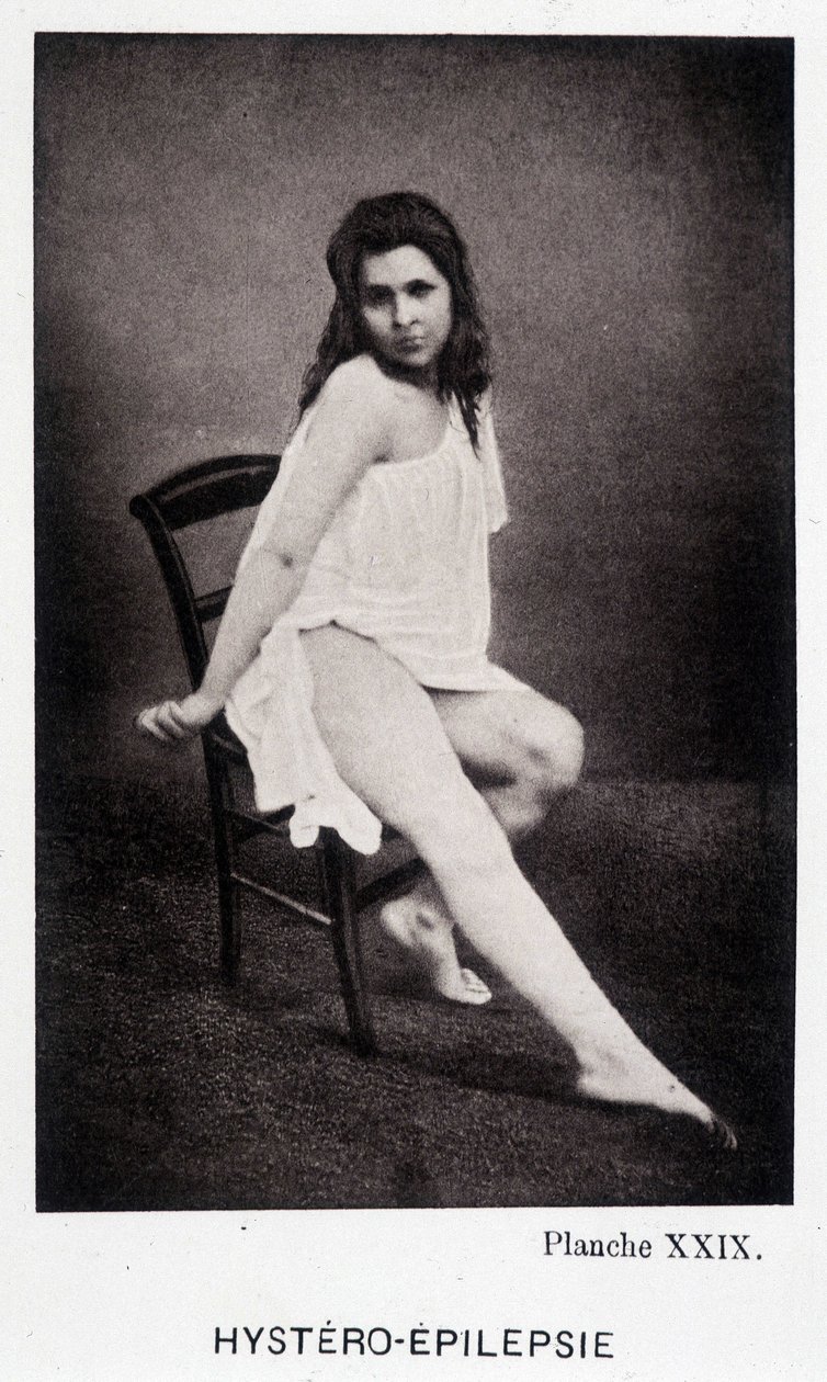 Hystero Epilepsie - “”Salpétrière 的摄影图像中的挛缩：Charcot 先生的服务”，Paul Regnard 和 Bourneville 作者 未知艺术家
