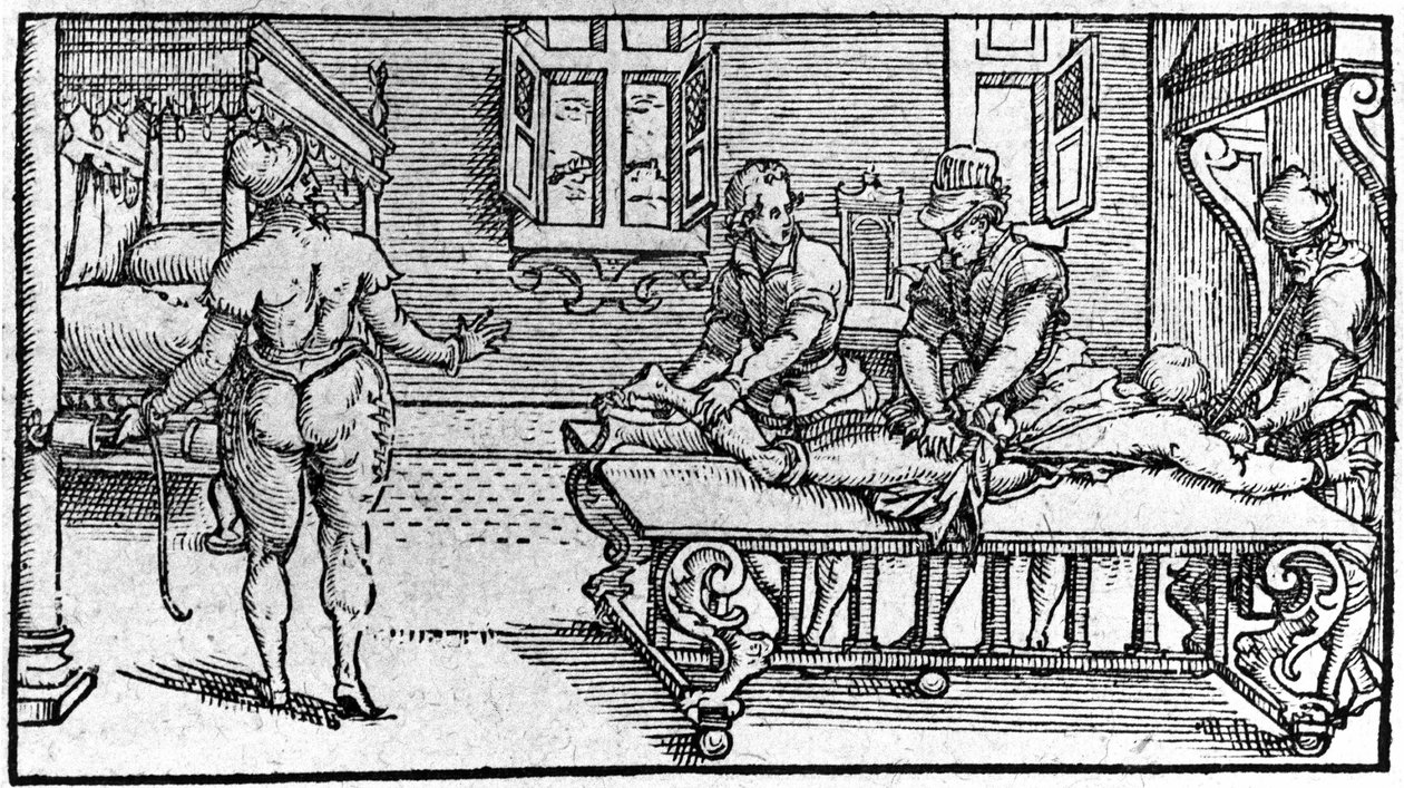 Reduction of a dislocation, -in “Traité Médical” by Ambroise Paré, circa 1560. 作者 未知艺术家