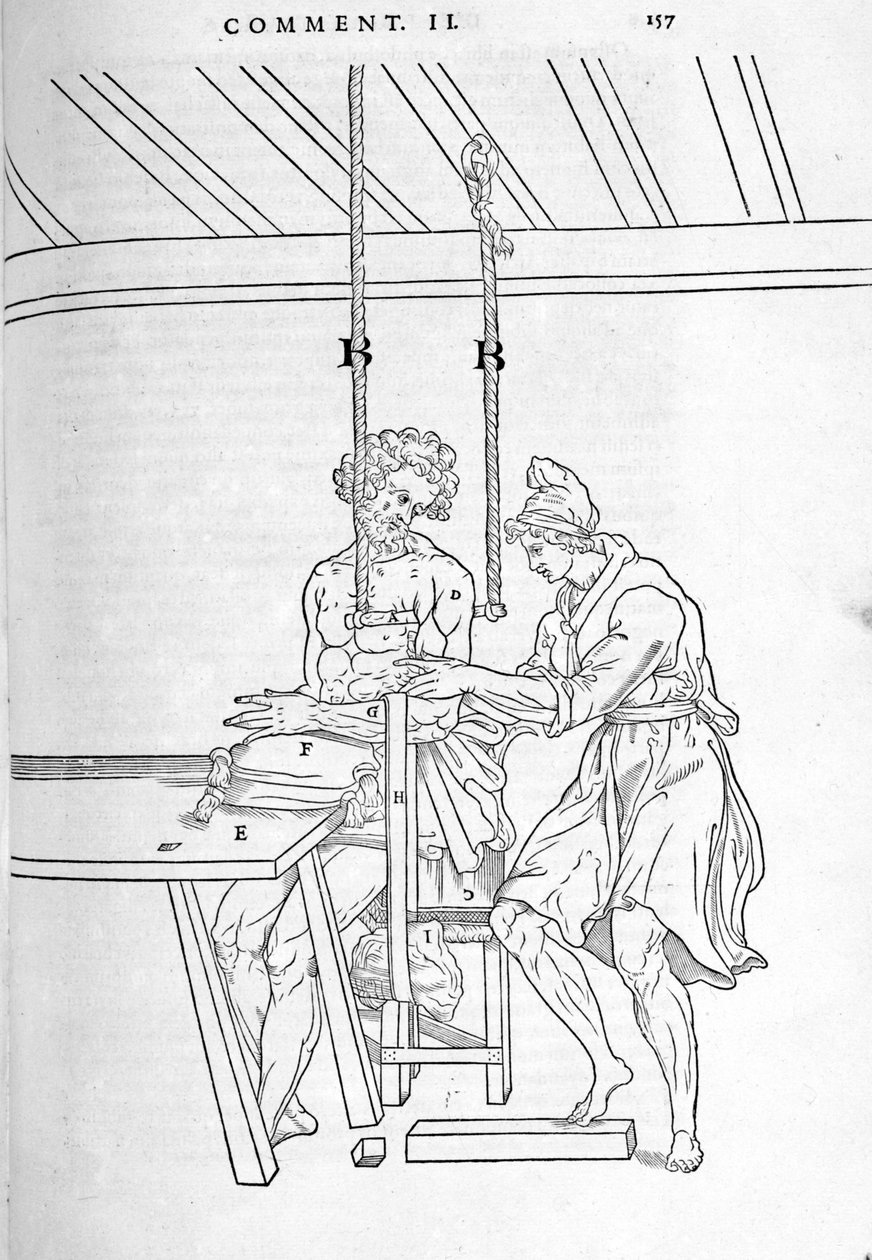 减少骨折。 插图板“”人体部位的解剖 lbri 三...“”，Carlo Stefano Riveriis，巴黎 1545。 作者 未知艺术家
