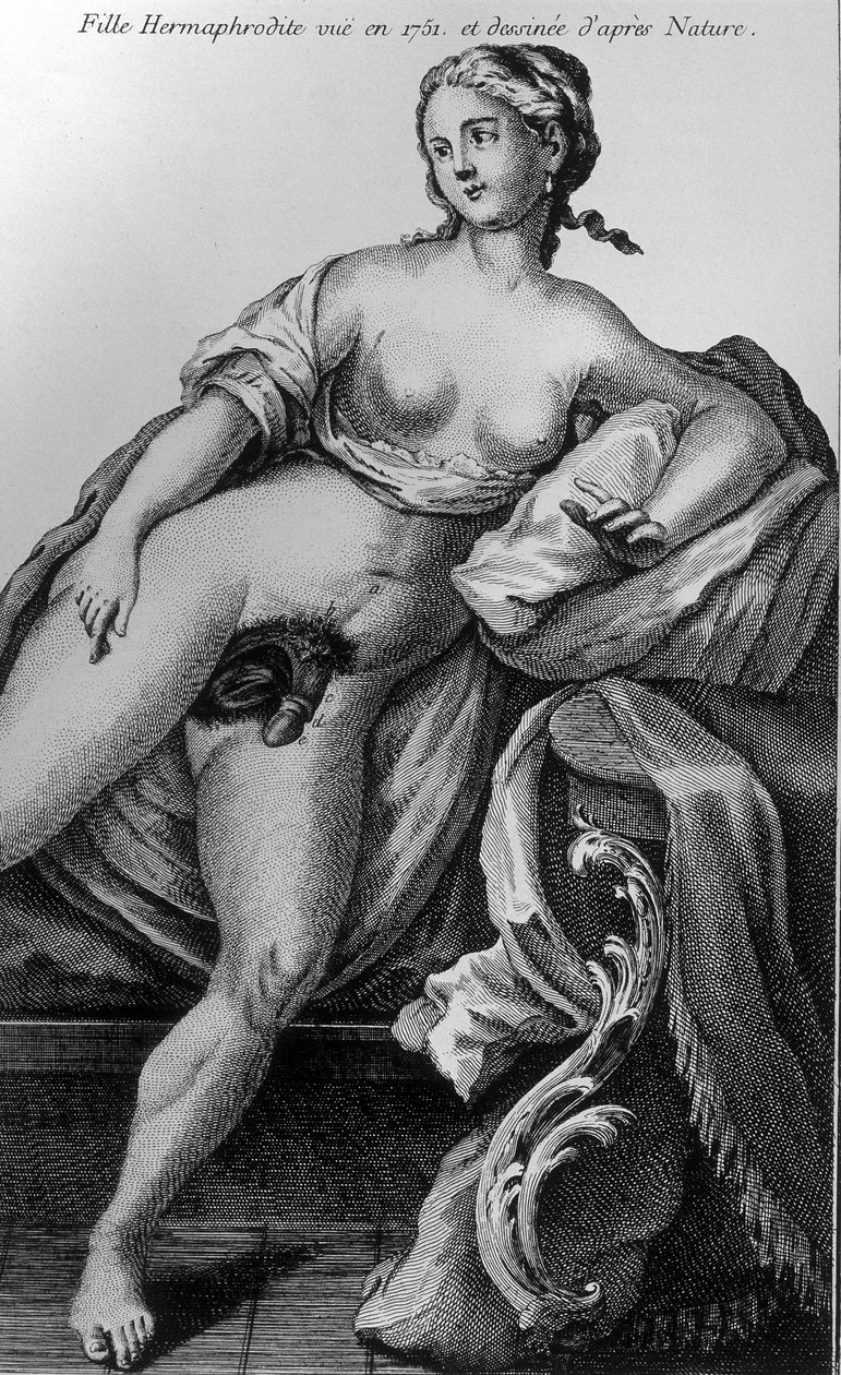 1751年看到的雌雄同体的女孩，取材于大自然。 作者 未知艺术家