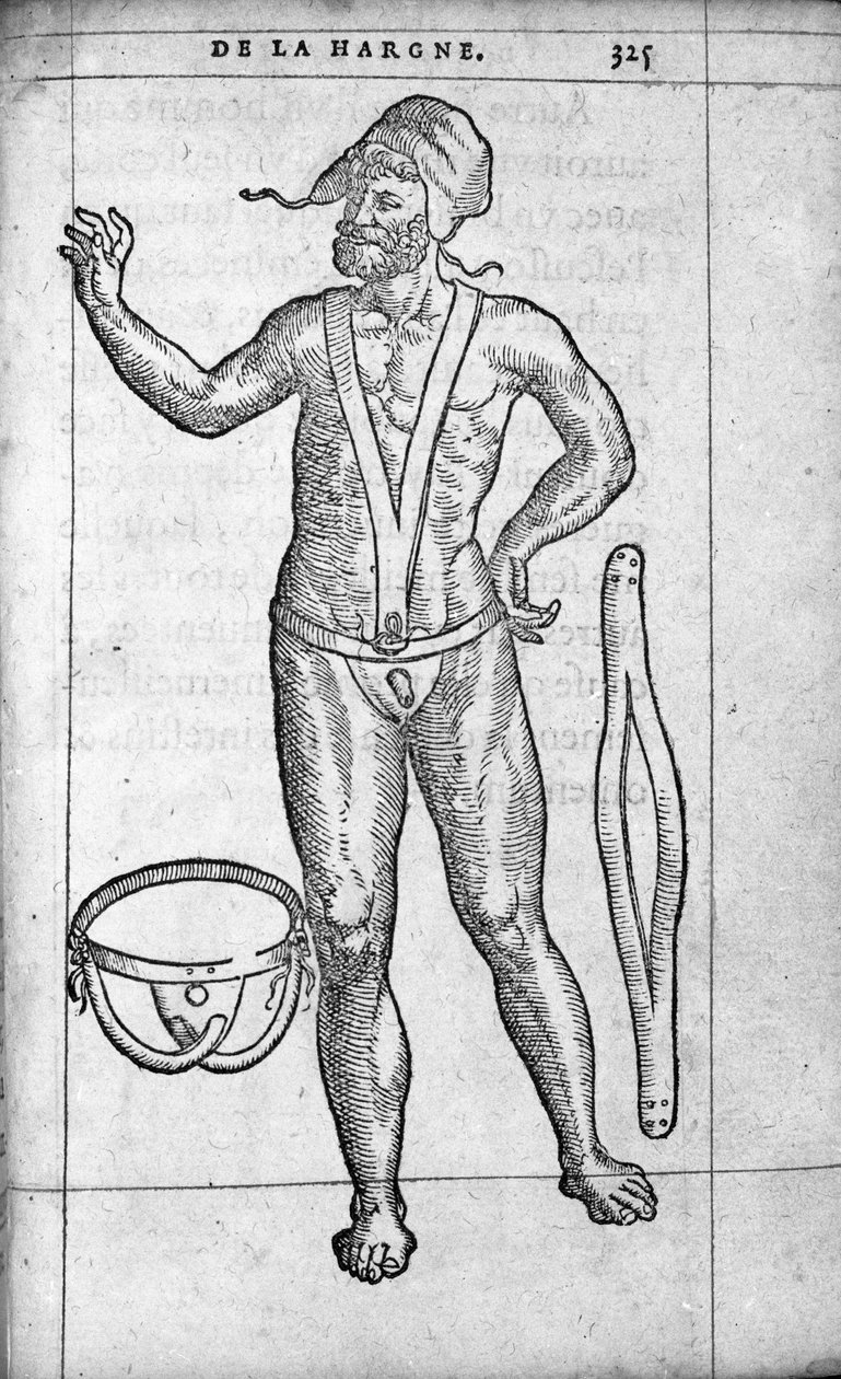 医学：疝带。 16 世纪法国内科医生兼外科医生 Ambroise Pare（1509-1590）的“De la hargne”雕刻 作者 未知艺术家