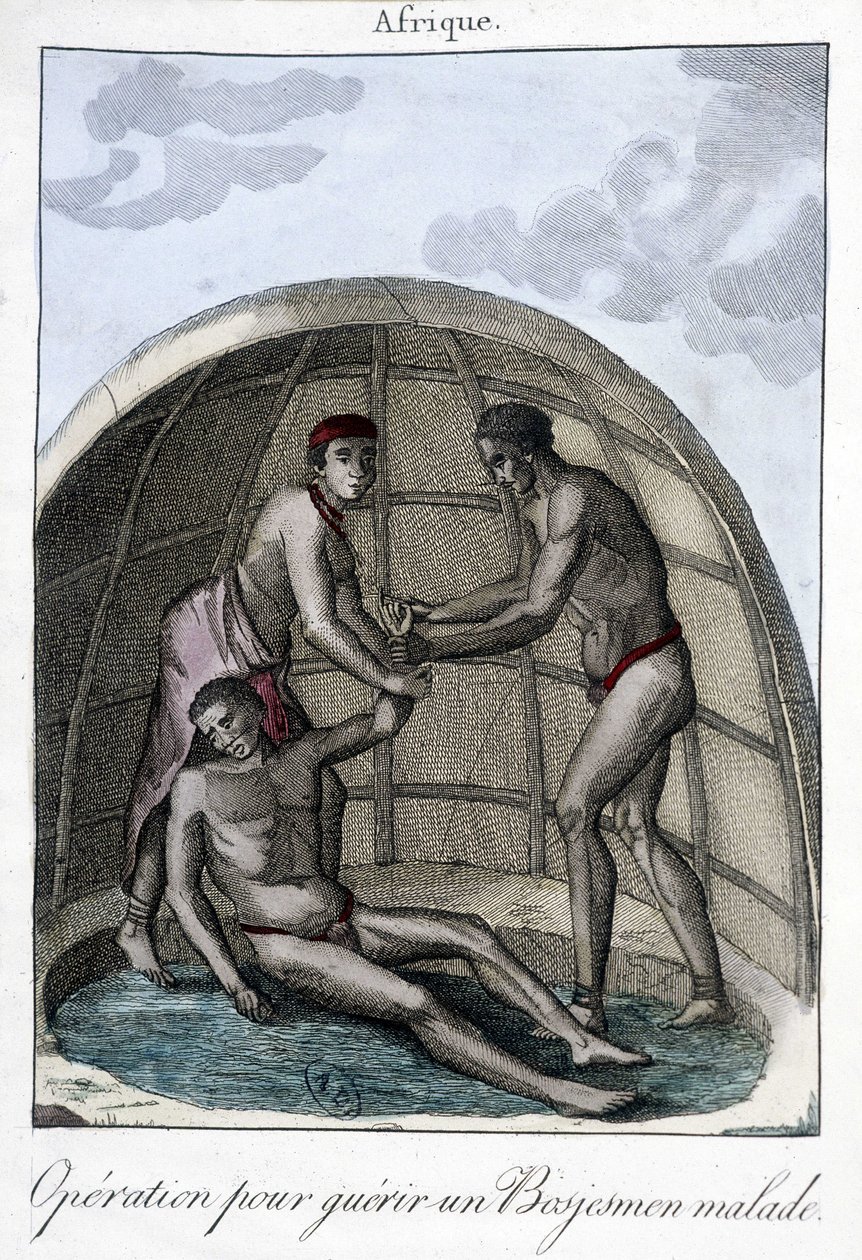 Operation to cure a Bojesmen - engraving 作者 未知艺术家