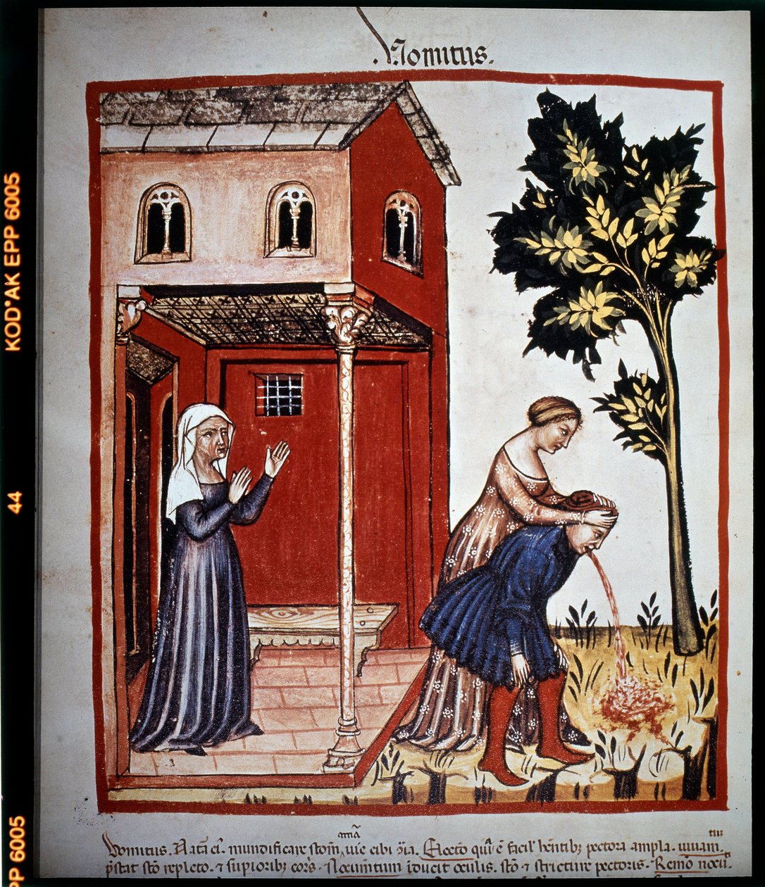14 世纪的医学论文“Tacuinum sanitatis”：呕吐。 B.N，维也纳。 作者 未知艺术家