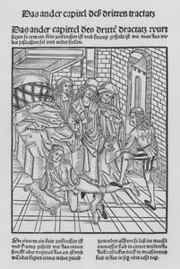 The Book of Cirurgia by Hieronymus Brunschwig (litho) 作者 （之后）德国学校