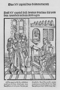 The Book of Cirurgia by Hieronymus Brunschwig (litho) 作者 （之后）德国学校