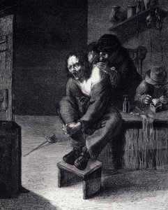 17 世纪阿德里安·布劳威尔 (Adrien Brauwer)（1608 年画）后的外科手术雕刻 作者 Adriaen（之后）Brouwer