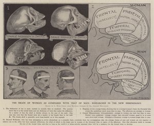 女人的大脑与男人的大脑的比较：新膈肌学研究（石膏）。