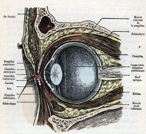 患有白内障的眼球的垂直切面 1881 年伦加德《自然与人》中的雕刻 私人收藏 作者 阿方斯·德马尔