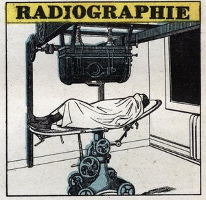 X-射线。X射线仪器。1925年的匿名插图。私人收藏。 作者 匿名匿名