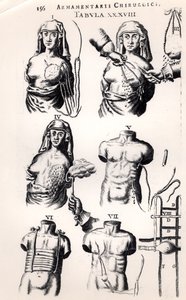 手术于乳腺癌，来自Armamentarii Chirurgici，Johannes Schultes（1595-1645）于1672年在阿姆斯特丹出版 作者 荷兰学校