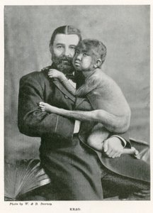 Krao，The Missing Link，于1887年在伦敦威斯敏斯特水族馆展出 作者 英国摄影师