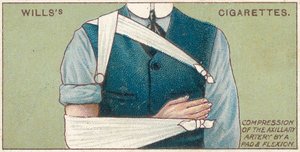 通过垫和屈曲来压缩辅助动脉，来自1913年Willss Cigarettes卡的First Aid系列的第41号 作者 英语学校