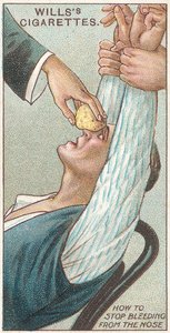 如何从1913年的Willss Cigarettes卡片急救系列中的31号鼻子出血 作者 英语学校