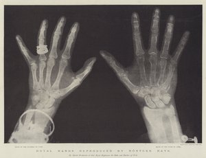 Royal Hands reproduced by Rontgen Rays (engraving) 作者 英语学校